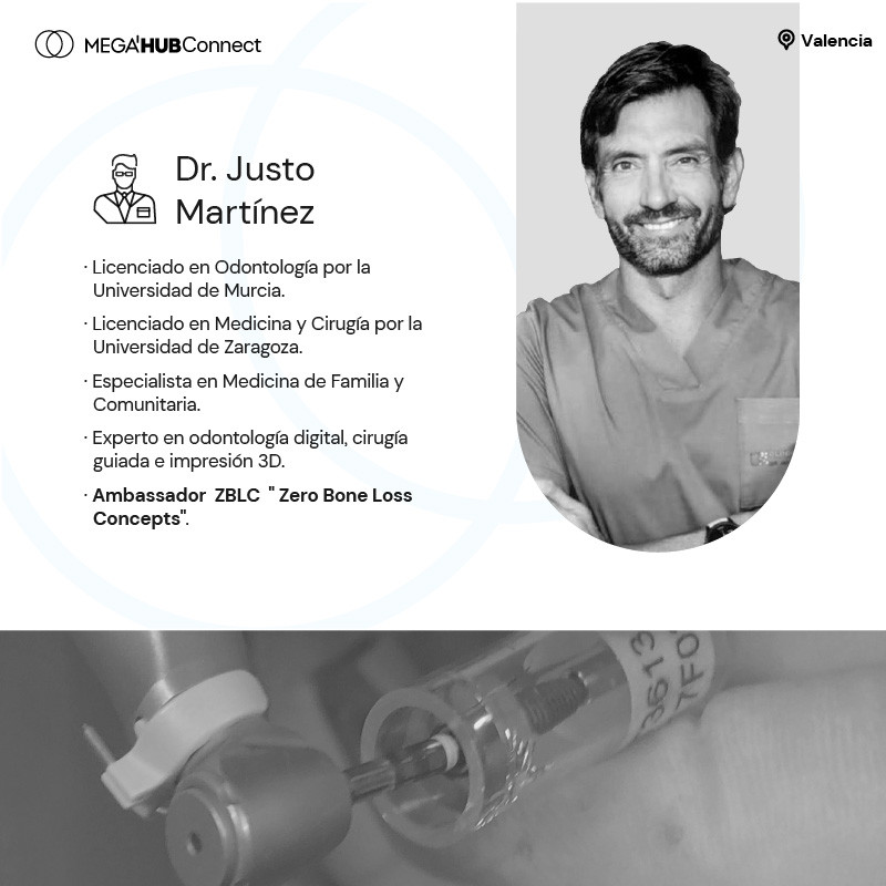 IMPLANTOLOGÍA INMEDIATA PREDICIBLE